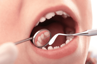 Regreso a clases: Tips de cuidado dental para niños