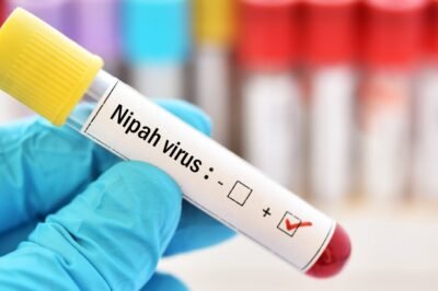 Todo lo que necesitas saber sobre el Virus NIPAH: